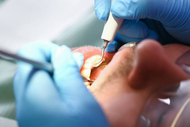 Best Mobile Emergency Dentist in Dallas, TX