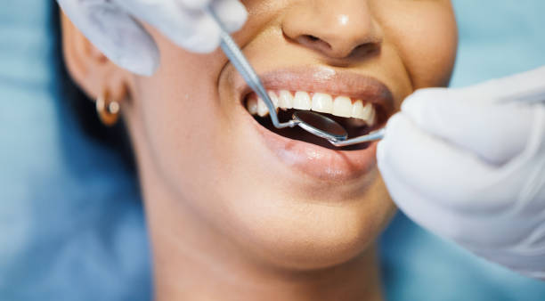 Best Emergency Dentist for Knocked-Out Tooth in Dallas, TX
